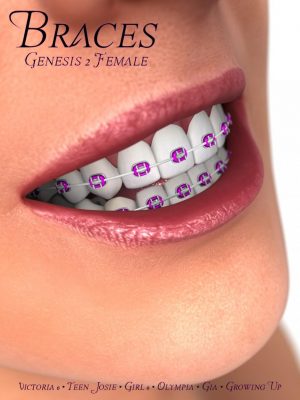 Braces for Genesis 2 Female(s)-Genesis 2女性的牙套