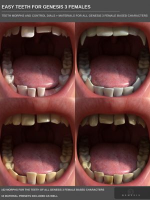 Easy Teeth for Genesis 3 Female(s) and Merchant Resource-简单的牙齿用于创世纪3女性和商家资源